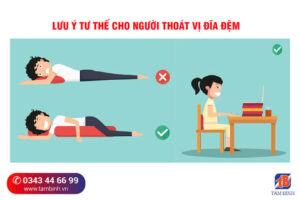 Thoát vị đĩa đệm – Bệnh lý cột sống phổ biến cần được phát hiện sớm